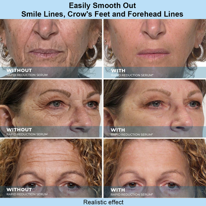 LOVIVONE™ Instant Face Temporary Tightener – Instant visible results in 60 seconds