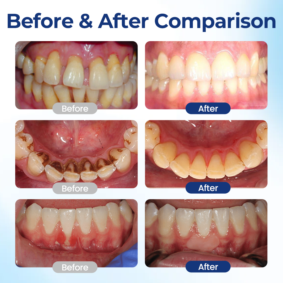Bloeamly Bee Repair Complex Oral Repair Solution