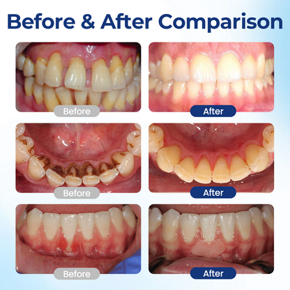 Bloeamly Bee Repair Complex Oral Repair Solution