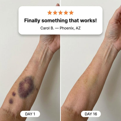 💥100K+ SOLD💕- TAILEDEN® Bruise Repair & Skin-Strengthening Cream